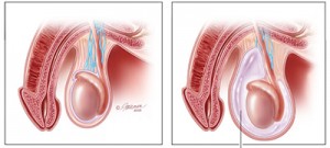 Rossiya teleboshlovchilari bilan jinsiy aloqa