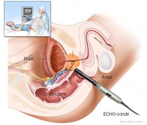 Echo prostaat