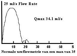 flowmetrie normaal