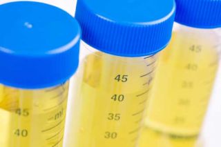 urine onderzoek